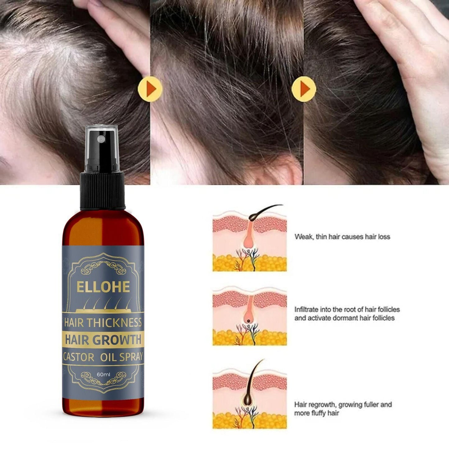 ELLOHE Hair Thickness Hair Growth Castor Oil Spray 60ml Pack of 1
