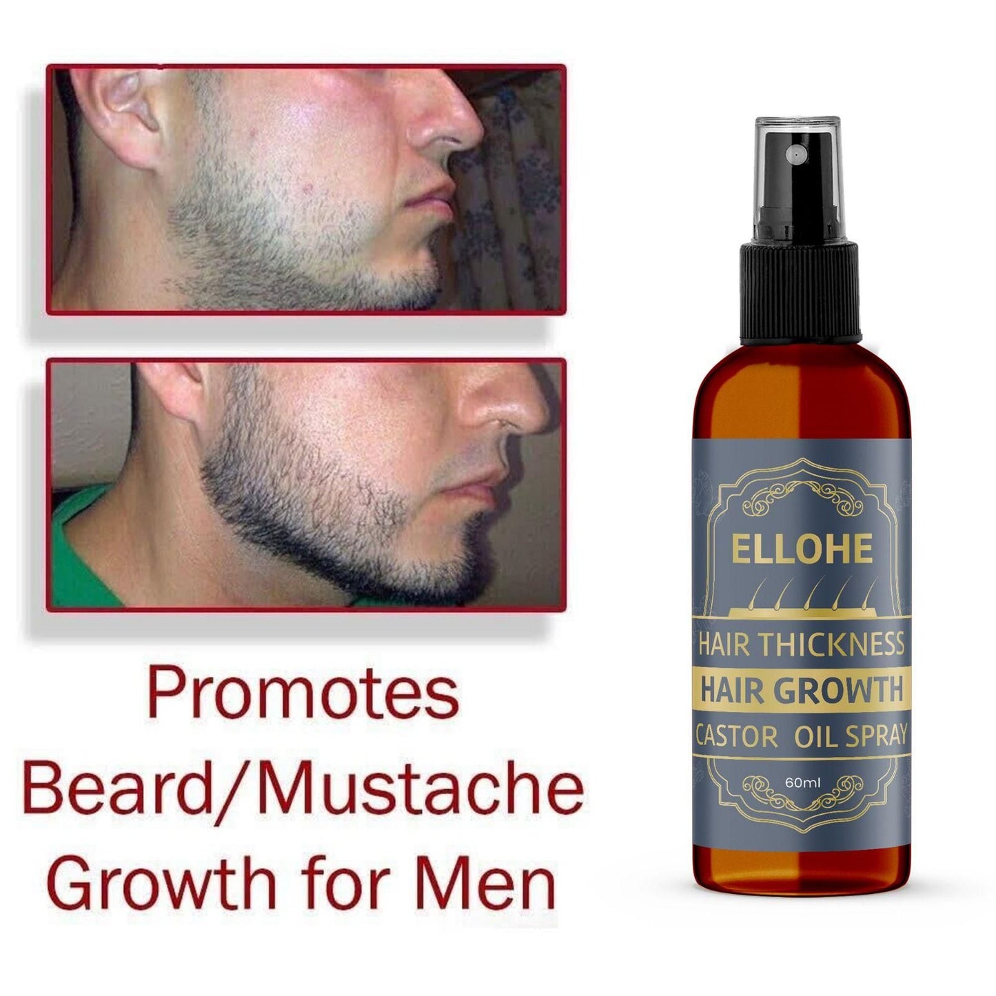 ELLOHE Hair Thickness Hair Growth Castor Oil Spray 60ml Pack of 1