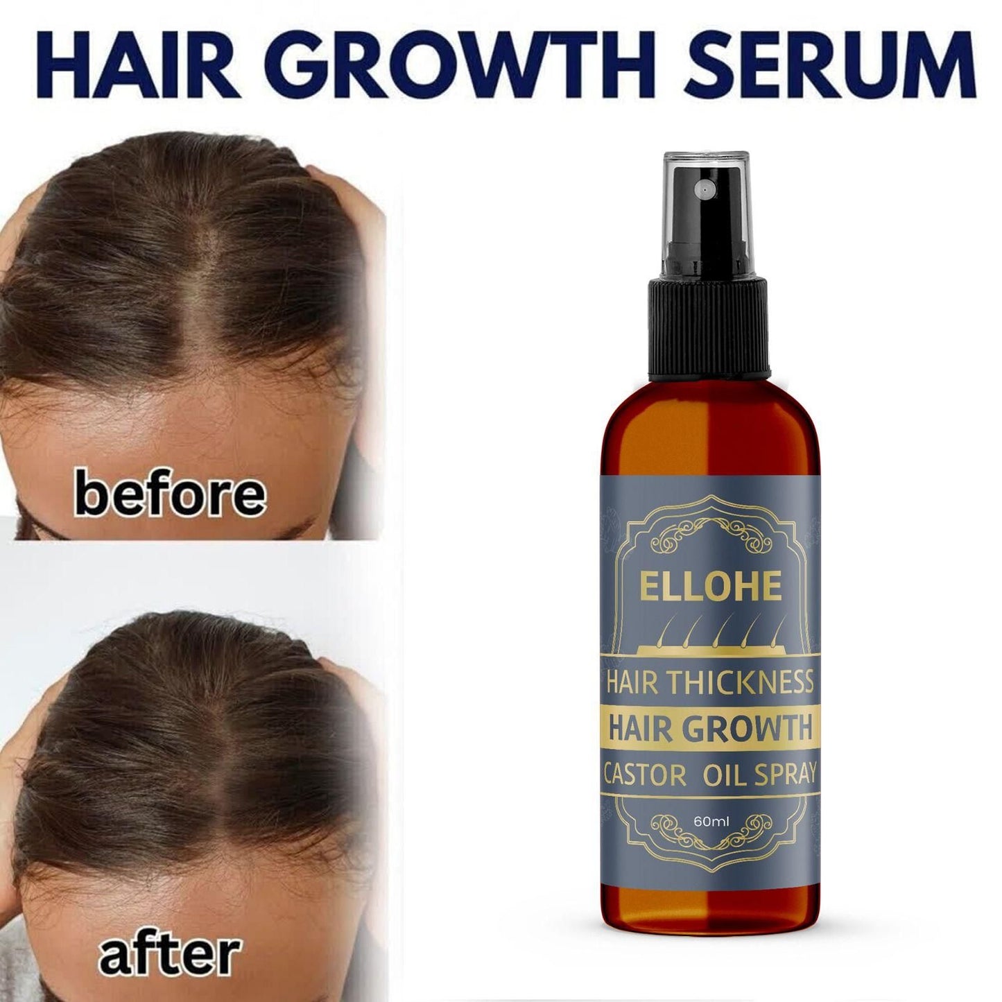 ELLOHE Hair Thickness Hair Growth Castor Oil Spray 60ml Pack of 1